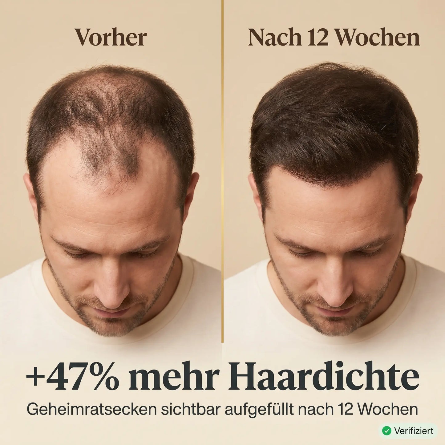Shinova Hair Elixir – For Men SHINOVA BEAUTY