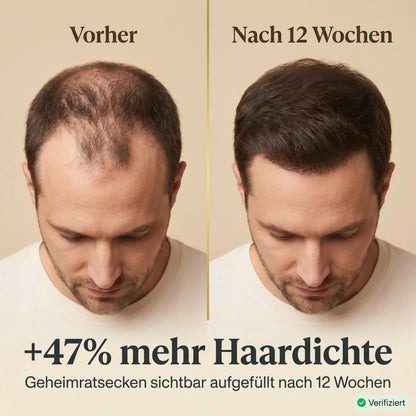 Shinova Hair Elixir – For Men SHINOVA BEAUTY